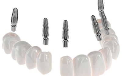 Smile Renewed: The Transformative Power of Replacing Missing Teeth