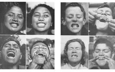 How Our Food Shapes Our Faces, Health, and Sleep