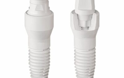 Dental Implants: An Investment in Whole-Body Health