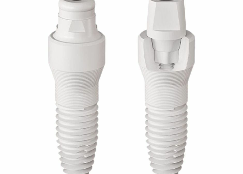 Dental Implants: An Investment in Whole-Body Health