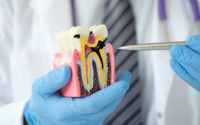 Can You Reverse a Cavity?