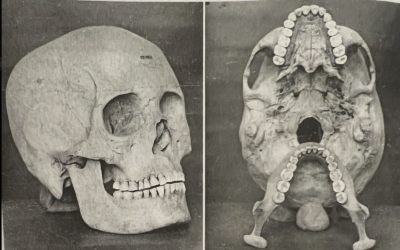 What Is Airway Dentistry?