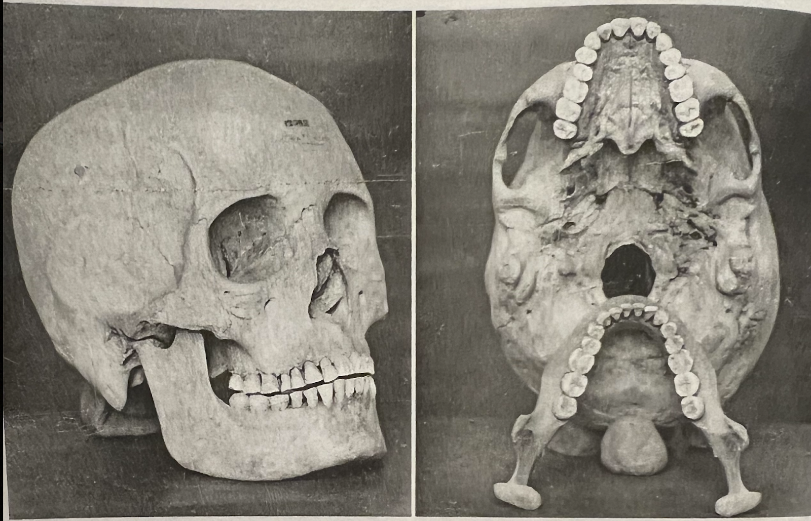 airway dentistry
