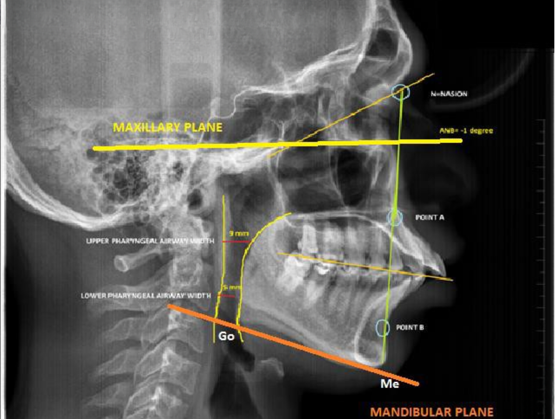 airway assessment