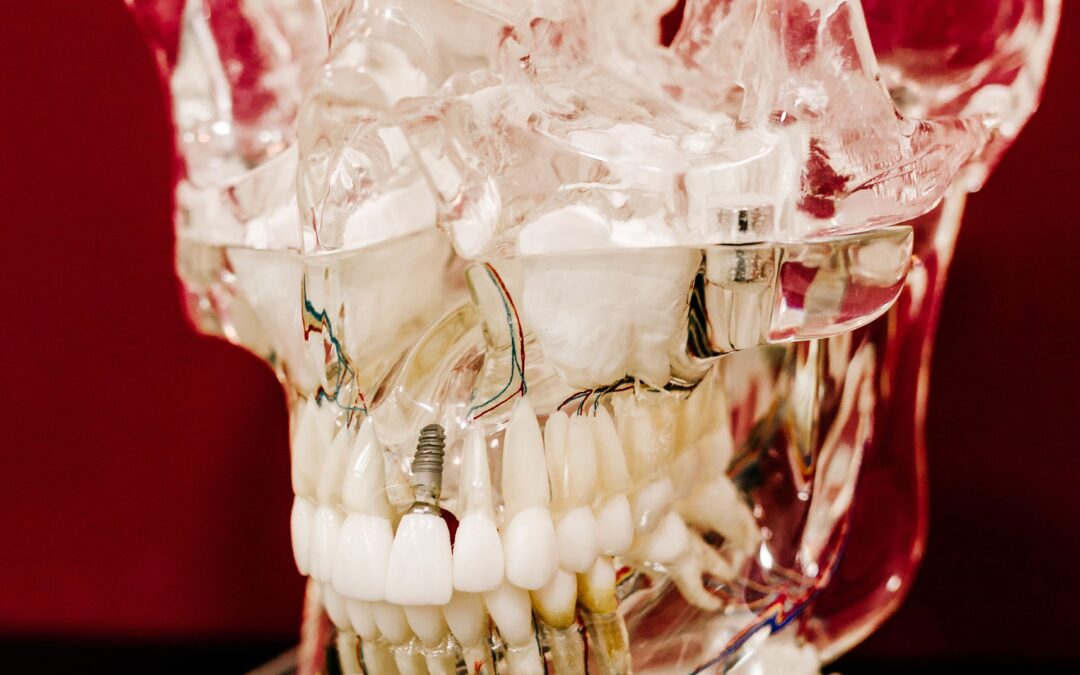 Debunking the Myths About Dental Implants